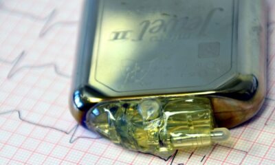 Perché utilizzare il pacemaker?
