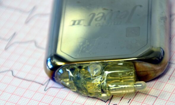 Perché utilizzare il pacemaker?
